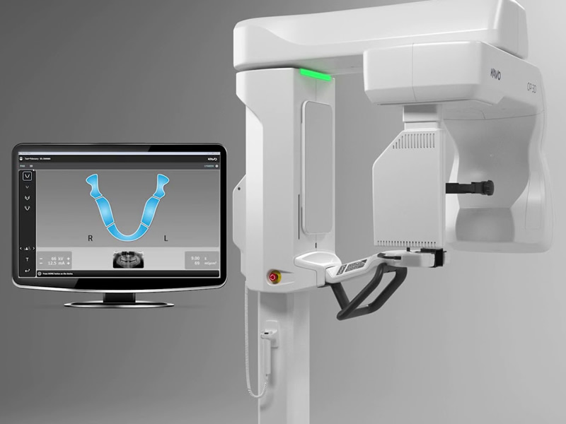 デジタルレントゲン「KaVo OP 3D」は、パノラマ撮影と3D撮影が可能なエックス線診断装置です。放射被曝量が従来のアナログレントゲン装置に比べて約10分の1と大幅に軽減されているのが最大の特徴です。